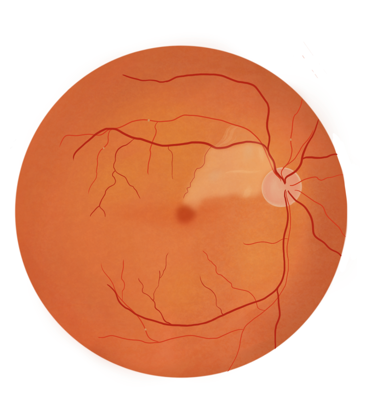 Visuel d'une OACR